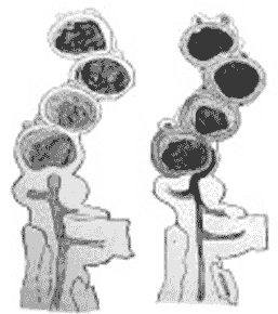Рис. 2. Отчленение клеток водоросли грибом 